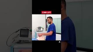 Chin Lift  anesthesia bagmaskventilation airway [upl. by Hsakaa214]