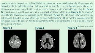 Desnaturalizacion y renaturalizacion de proteinas asociados a un caso clinico [upl. by Assetniuq]