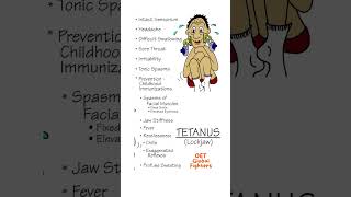 Tetanus Sign and Symptoms OET Test [upl. by Nepean]