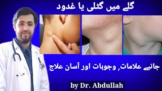 Swollen Lymph Nodes In Neck Symptoms Causes amp Treatment  Lymphadenopathy  Gale Ki Gilti Ya Ganth [upl. by Hajan]