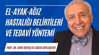 Elayakağız hastalığının belirtileri nedir ve nasıl tedavi edilir [upl. by Cirenoj]