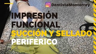 SELLADO Periférico IMPRESIÓN FUNCIONAL 👅 Prótesis Dental Inferior Parte1 ProtesisDentales dental [upl. by Paxon]