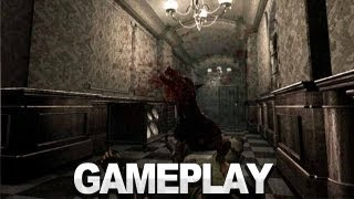 Resident Evil  Dogs Attack Gameplay [upl. by Muhcan]