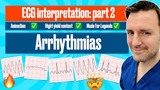 Arrhythmias A Visual Guide with ECG Criteria ecgmadeeasy [upl. by Yrian]