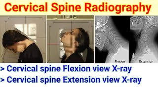 Cervical spine radiography  Flexion amp Extension view Xray  In radiography  By BL Kumawat [upl. by Eerahc]