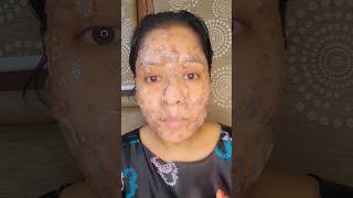 DIY rice water and flaxseed face pack for clear amp glowing skin  face mask for glass skin [upl. by Dunham]