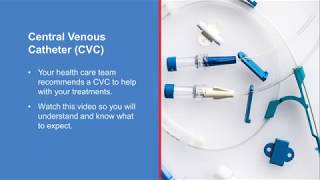 Central venous catheter procedure [upl. by Marlowe]