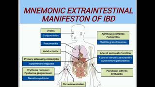 MNEMONIC EXTRAINTESTINAL MANIFESTON OF IBD medicinelectures medicineeducationtalks [upl. by Chaker544]