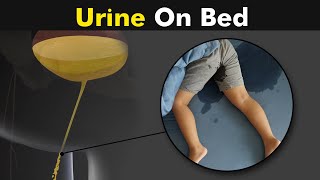 Why Childs and some adults do urine on bed  Bedwetting  Causes and treatment UrduHindi [upl. by Godfry]