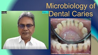 Ep 9 Microbiology of Dental Caries  Become a Dentist in Australia UK Canada  NEETMDS  ADC Exam [upl. by Dyanna514]