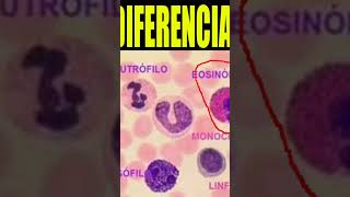 🩸Que significa tener NEUTROFILOS EOSINOFILOS Y MONOCITOS Altos🔬 shorts [upl. by Geminian377]