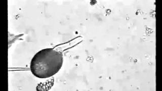 Rop1Ps promote actin cytoskeleton dynamics and control the tip growth of lily pollen tube [upl. by Rats776]