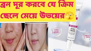 Rtopr mangoa cream reviewব্রনএকনি দূর করতে বেস্ট ক্রিমFatema [upl. by Aldredge481]