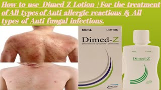 How to use Dimed Z LotionFor the treatment of All types of Anti Allergic reaction amp Anti fungal [upl. by Osei829]