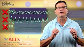 ACLS Adult Cardiac Arrest Algorithm  PEAAsystole [upl. by Logan]