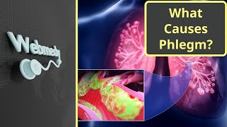 What Causes Constant Phlegm Mucus in Throat [upl. by Wayne]