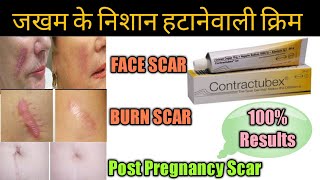 Contractubex Gel review पुराने से पुराने scars Marks को जड़ से मिटा देता है ये जेल।। [upl. by Stratton495]