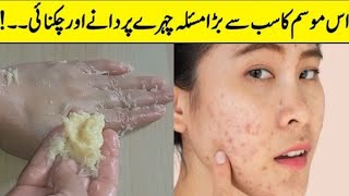 Apply This On Your FaceTo Remove Pimples Marks Dark Spot Skin Whitening Face Pack [upl. by Errehs]