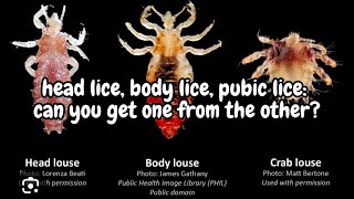 Head lice body lice pubic lice the differences l lice removal service explore hair [upl. by Matthieu]