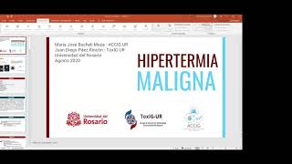 Hipertermia Maligna [upl. by Tabor]