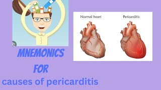 MNEMONICS for causes of pericarditis [upl. by Beora]