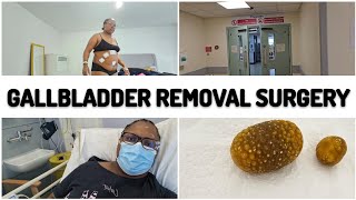 Gallbladder Removal Surgery Vlog  Laparoscopic keyhole Cholecystectomy [upl. by Alasteir]