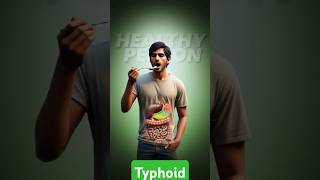 Typhoid fevertrending medicalinformation mbbs shorts nursing [upl. by Cyndie846]