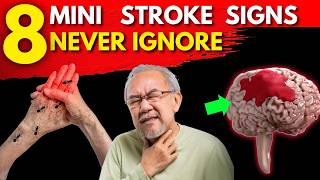 8 Signs of a Mini STROKE DO NOT IGNORE  Transient Ischemic Attack TIA [upl. by Kerek]