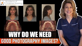 Why do we need good Dental Photography Images [upl. by Ethelstan]