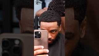 Hair Transplant Week 30👨🏾‍🦲‼️ Pt4 [upl. by Bay]