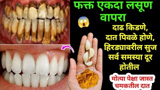 घरातील फक्त या 2 वस्तू वापरा दातांन संबंधित सर्व समस्या दूर होतील😱 kitchen tips  home remedies [upl. by Enilrem699]