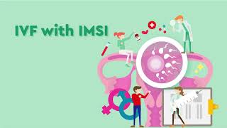 IVF with IMSI [upl. by Brenton]