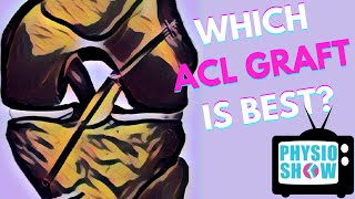 Which ACL Graft Is Best For Returning to Sport [upl. by Ynnad431]