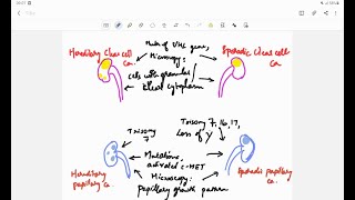 Renal cell carcinoma RCC  Pathology  Handwritten notes [upl. by Annawahs]