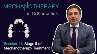 Mechanotherapy in Orthodontics Vol II Stage II of Mechanotherapy Treatment 011 [upl. by Nesto]