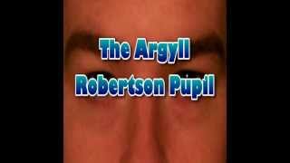 Pupil testing and responses Argyll Robertson Pupil [upl. by Holey331]