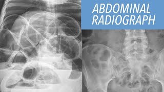 Abdominal Radiograph Made Easy [upl. by Attayek905]