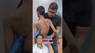 Scoliosis treatment chlorosis chiropractor physiotherapy shoulder motivation chiropractic [upl. by Halivah]