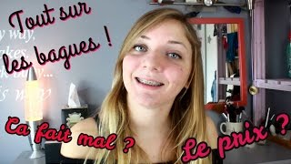 Les bagues dentaires  je vous dis tout  🌸 Aie Prix Mon expérience [upl. by Motteo51]