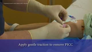 PICC Line Removal [upl. by Ahsyla]