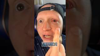 When you have pink eye comedy funny gamer relatable skit [upl. by Liemaj]