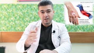 Thrombophlebitis التهاب الوريد الخثري [upl. by Kelli]