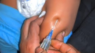 How to give an im Intramuscular injection in the buttocks [upl. by Iniffit]