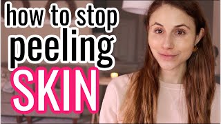 How to STOP PEELING SKIN Dr Dray [upl. by Rramel621]