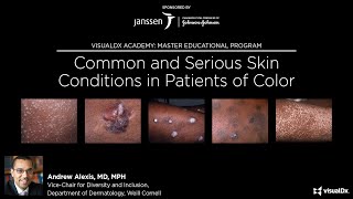 Common and Serious Skin Conditions in Patients of Color [upl. by Earased]