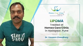 Lipoma Treatment by Homeopathic Doctor in Hadapsar Pune  Dr Vaseem Choudhary [upl. by Hankins664]