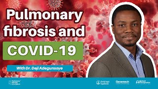 COVID 19 amp Pulmonary Fibrosis Updates amp Insights [upl. by Cheng511]