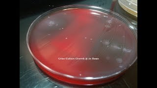 Urine Culture Colony Growth with Multiple Bacteria [upl. by Tabitha]