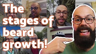 Growing a beard stages WITH PICTURES  Every embarrassing stage with tips [upl. by Anaitsirk675]