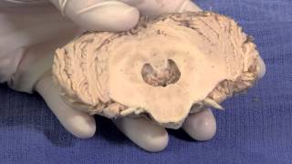 The Cerebellum Neuroanatomy Video Lab  Brain Dissections [upl. by Sillyrama]